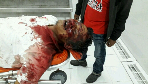 Foto : mayat Anto Ginting saat di Rumah Sakit dr.Hadrianus Sinaga Pangururan, sebelum di Autopsi ke rumah sakit Bhayangkara Polda Sumut di Medan