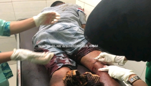 Foto : Satu dari Dua tersangka, Brigadir Sofyan (35) bertugas di Satbhara Polres Samosir,  ditembak bagian kaki dikarenakan mau melarikan diri