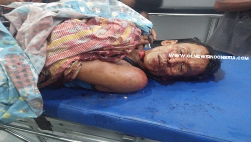 Ket foto : Korban  pembunuhan atas nama Algopur warga Lampung saat berada di rumah sakit pada Minggu (20/07)  2019