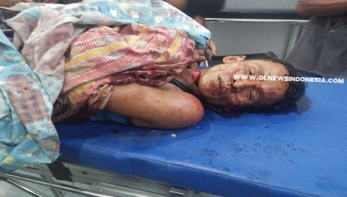 Ket foto : Korban pembunuhan atas nama Algopur warga Lampung saat berada di rumah sakit pada Minggu (20/07) 2019
