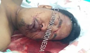 Ket foto : Korban saat di rumah sakit