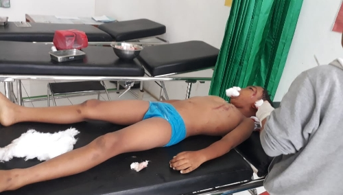 Ket foto : Korban tewas akibat Lakalantas Tunggal di Desa Merek Kecamatan Merek Kabupaten Karo, Jumat (08/11) 2019 (Ist)