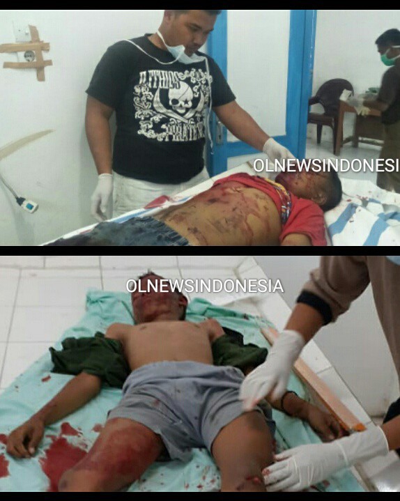 Ket foto : Kedua Korban Laka Lantas di jalan umum Berastagi-Simpang Empat Kabupaten Karo, saat di tangani tim medis RSU Kabanjahe, Senin (23/03) 2020 (Ist)