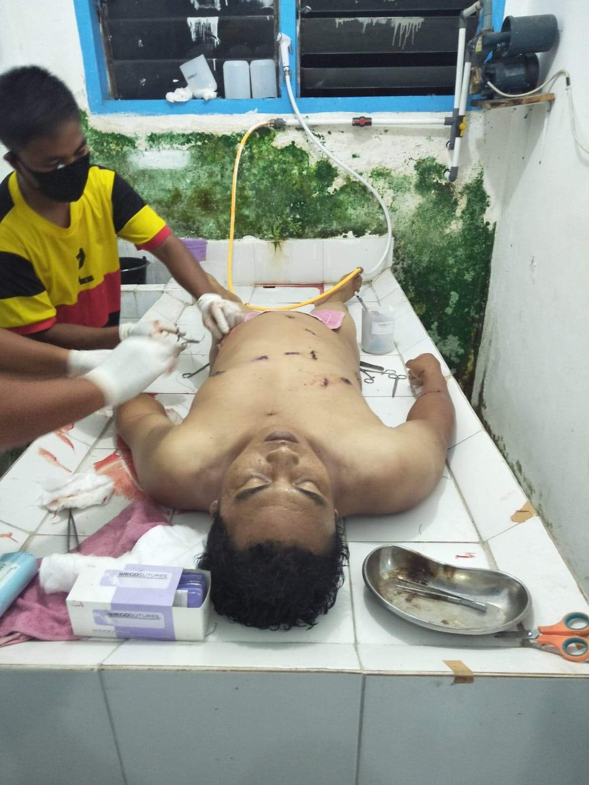 Ket foto : Korban saat ditangani tim medis di rumah sakit umum Kabanjahe