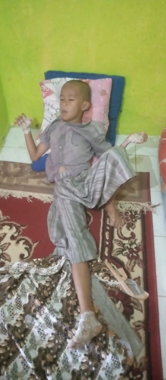 Ket poto :nampak terlihat adif seorang anak yang dianiaya sedang terbaring lemah (sabtu.09/01/2021)