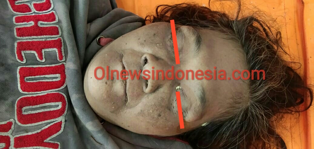 Ket Foto : Korban mayat Wanita yang ditemukan di sebuah kamar rumah tak berpenghuni,kini sudah di RSU Kabanjahe, Selada (02/03) 2021 (Ist)